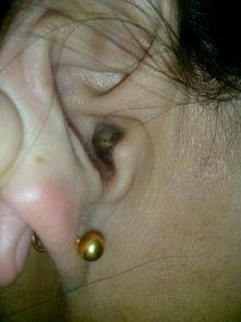 耳膜穿孔后，我让恶人伏法,恶人伏法，正义得以伸张